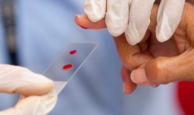 Hemofilia: recomiendan no suspender los controles