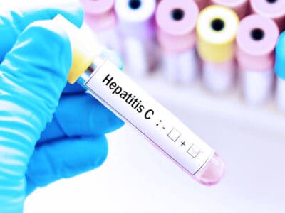 Hepatitis C, lanzan una campaña en Mar del Plata que busca pacientes para curarlos