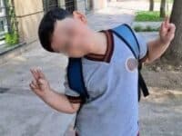 Nuevo parte médico de Bastian: “estable, en coma farmacológico”