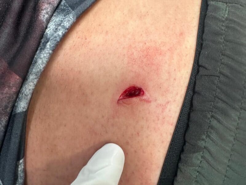 Mar del Plata insegura: apuñalan a un médico mientras se ejercitaba en la costa